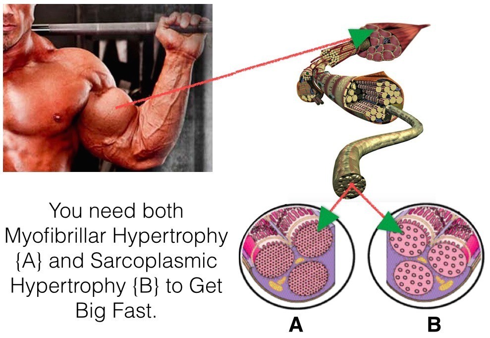 Sarcoplasmic Hypertrophy