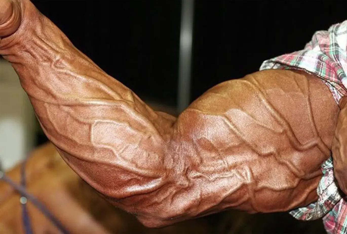 vascularity