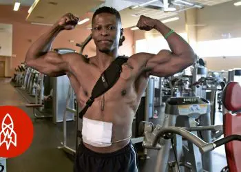 Meet The Fitness Model Who Lives Without A Pulse