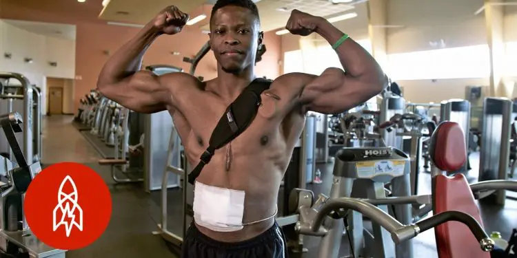 Meet The Fitness Model Who Lives Without A Pulse