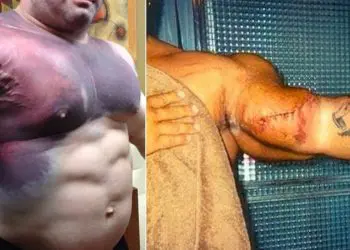 WATCH: The 8 Bodybuilders Whose Muscles Exploded