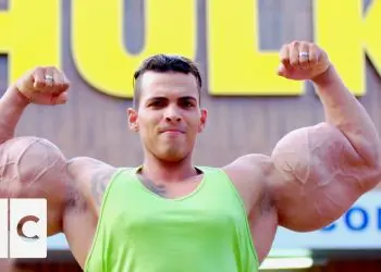 WATCH: New Documentary on Synthol Abusers – Do These Guys Even Lift?