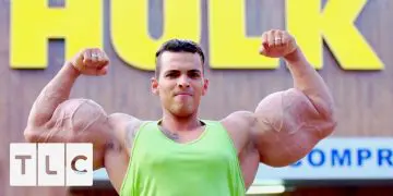 WATCH: New Documentary on Synthol Abusers – Do These Guys Even Lift?