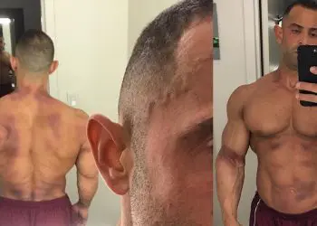 What Happened To Guy Cisternino At The 2017 New York Pro?