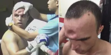 Muay Thai fighter skull