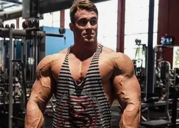 Calum von Moger: I’ll Need Surgery To Fix My Bicep