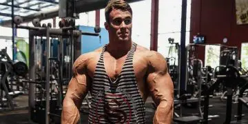 Calum von Moger: I’ll Need Surgery To Fix My Bicep