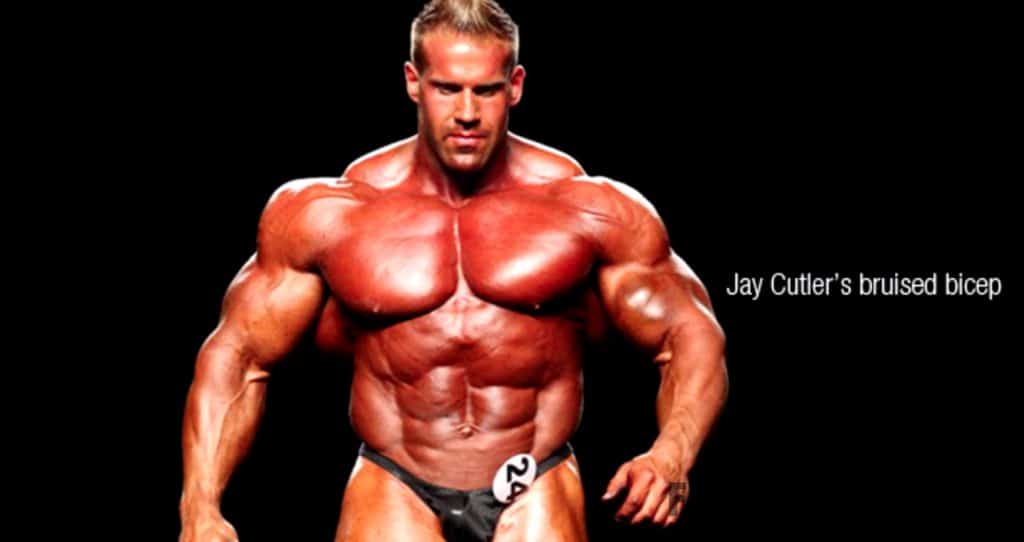 Jay Cutler 2011 Biceps Injury