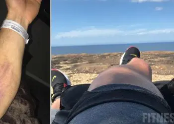 Calum Von Moger Injured