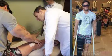 WATCH: Calum von Moger Injury Update, Talks About If He’ll Continue His Career