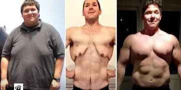 Loose Skin After Weight Loss