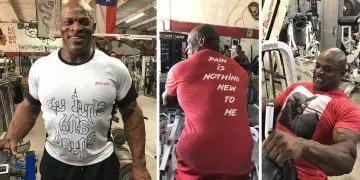 Ronnie Coleman Needs Corrective Surgery
