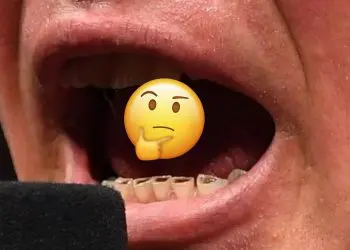 Something is seriously wrong with Brock Lesnar’s teeth