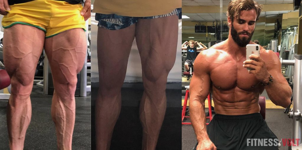 Calum Von Moger Shares Shocking Before And After Quad Tear Picture Need