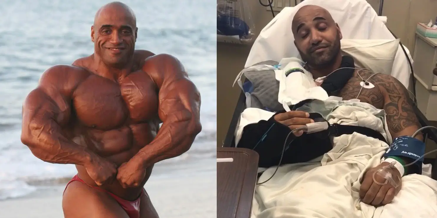 Dennis James Surgery