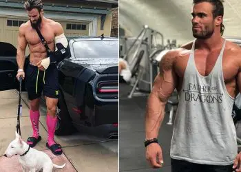 Calum Von Moger Update Fans On His Successful Bicep Surgery