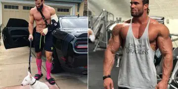 Calum Von Moger Update Fans On His Successful Bicep Surgery