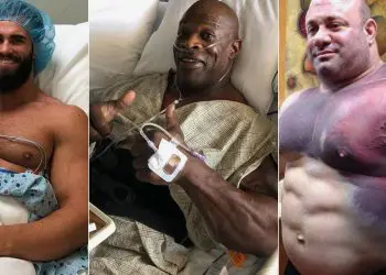 Bodybuilding Injuries