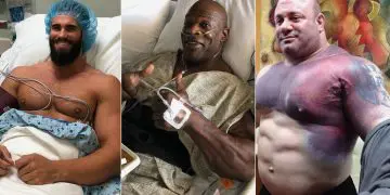 Bodybuilding Injuries