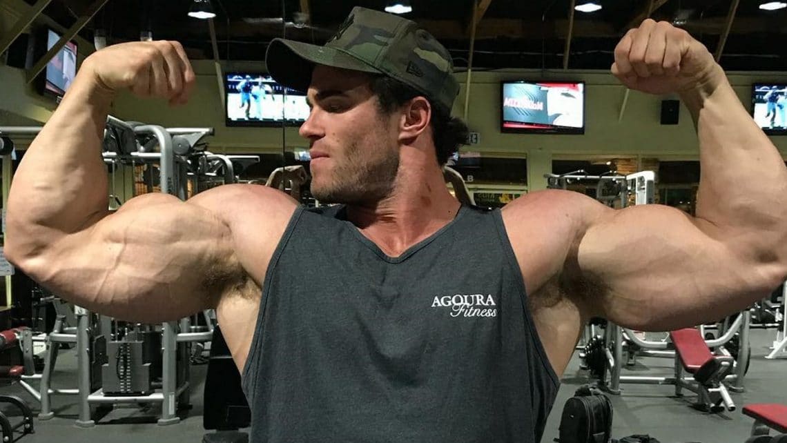 Calum Von Moger Begins Physical Therapy For His Big Return