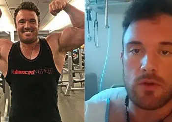 Bodybuilder Almost Loses Leg From Injecting Infected Steroids