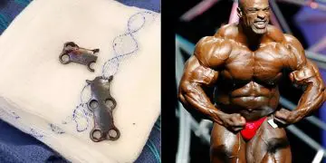 Ronnie Coleman Shares Scary Details Of Most Recent Surgery