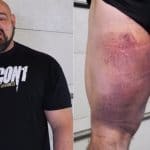 Brian Shaw Hamstring Injury