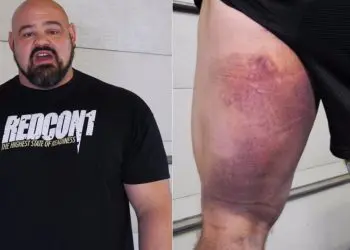 Brian Shaw Hamstring Injury