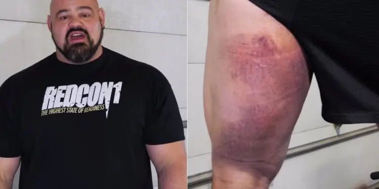 Brian Shaw Hamstring Injury