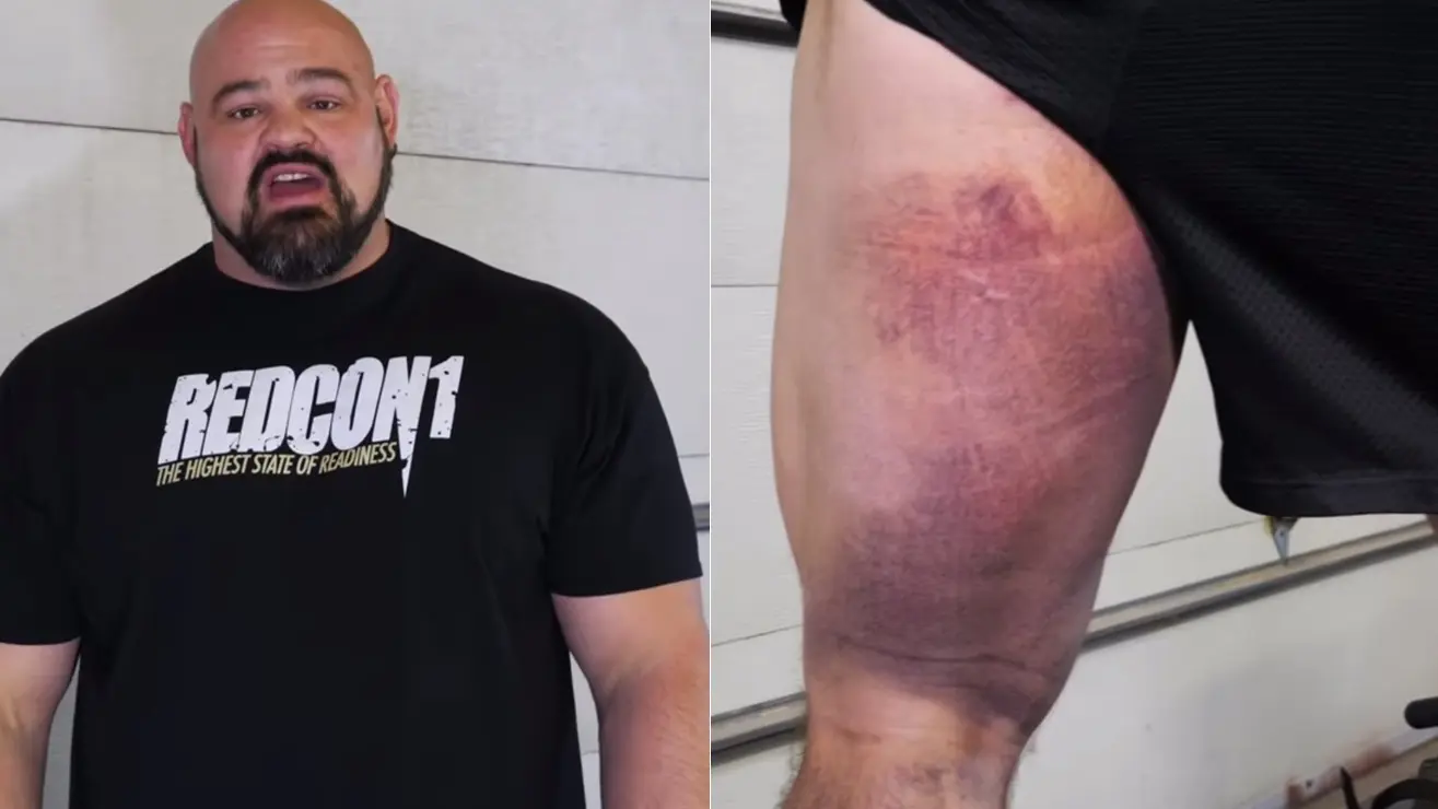 Brian Shaw Hamstring Injury