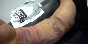 Antoine Vaillant Bicep Tear