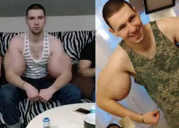 Synthol Kid Ruki Bazuki