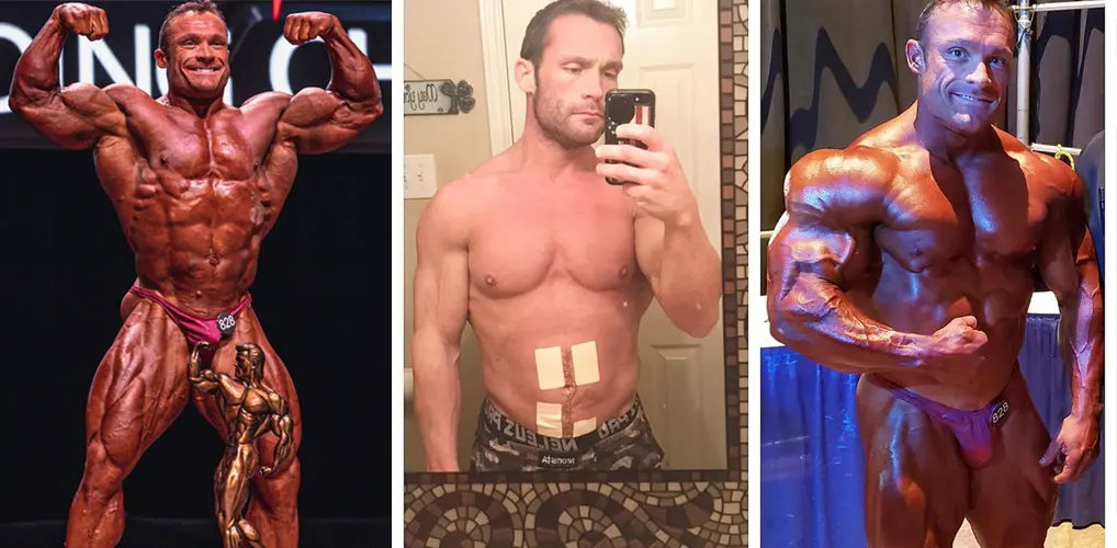 Matthew Schmidt Ifbb Pro 1