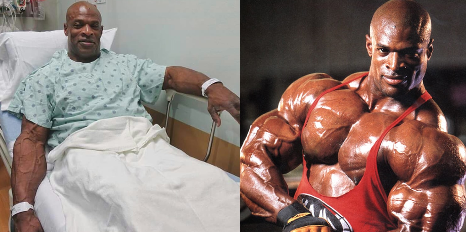 Breaking Ronnie Coleman Hospitalized Needs Emergency Surgery Fitness Volt
