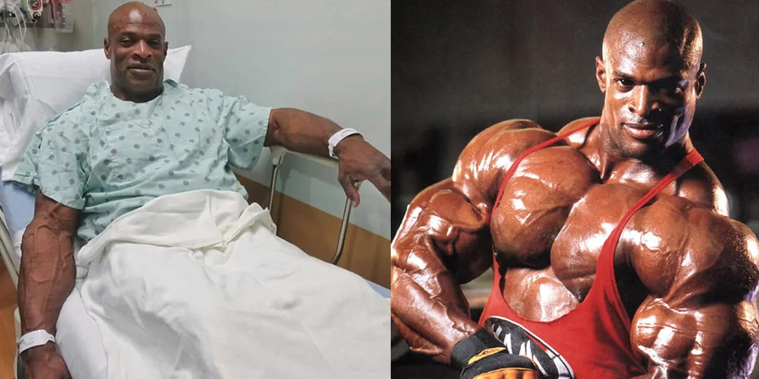 Ronnie Coleman Hip Surgery