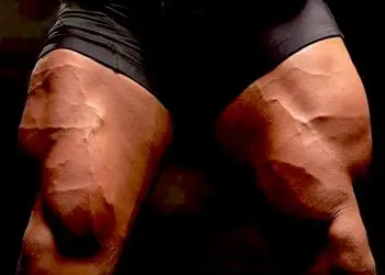 Quadriceps Exercises