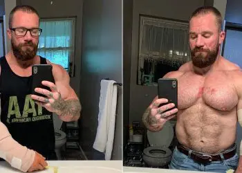 Seth Feroce Tears Triceps