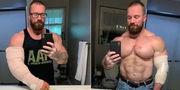 Seth Feroce Tears Triceps