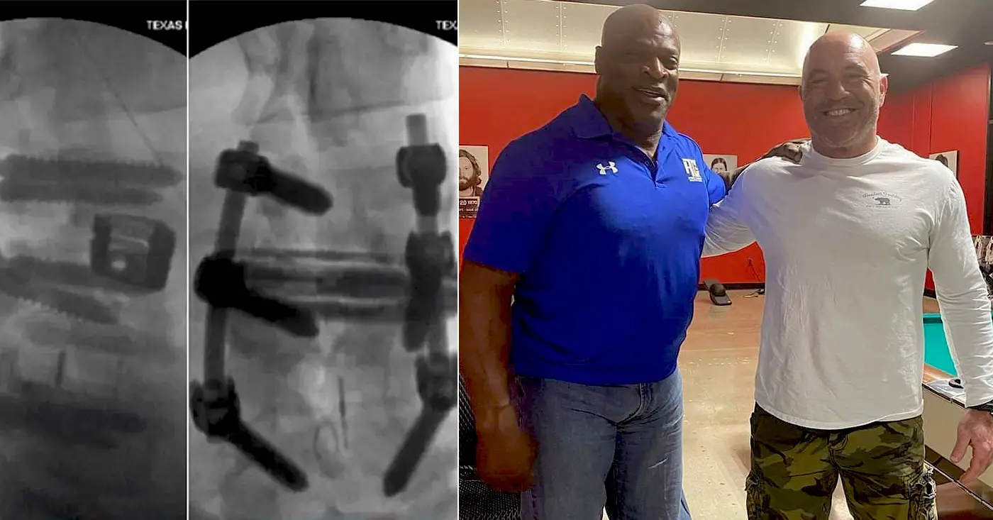 Ronnie Coleman Tells Joe Rogan About His 13 Post Bodybuilding Sugeries
