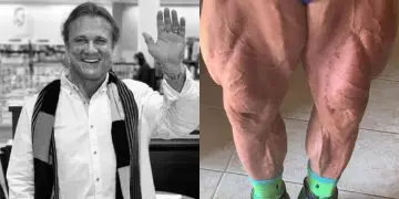Tom Platz