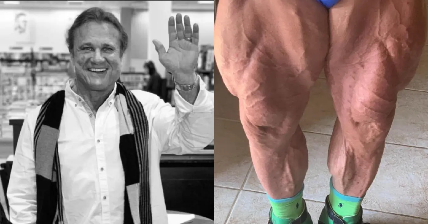 Tom Platz