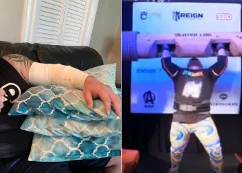 Rob Kearney Tears Triceps