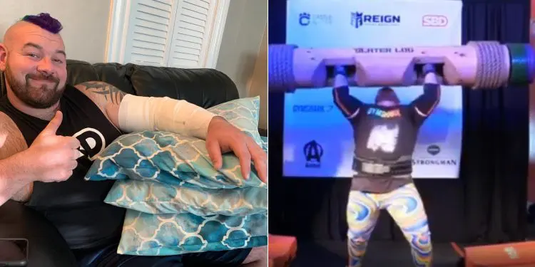 Rob Kearney Tears Triceps