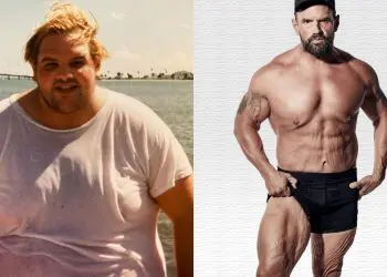 Loose Skin After Weight Loss