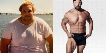 Loose Skin After Weight Loss