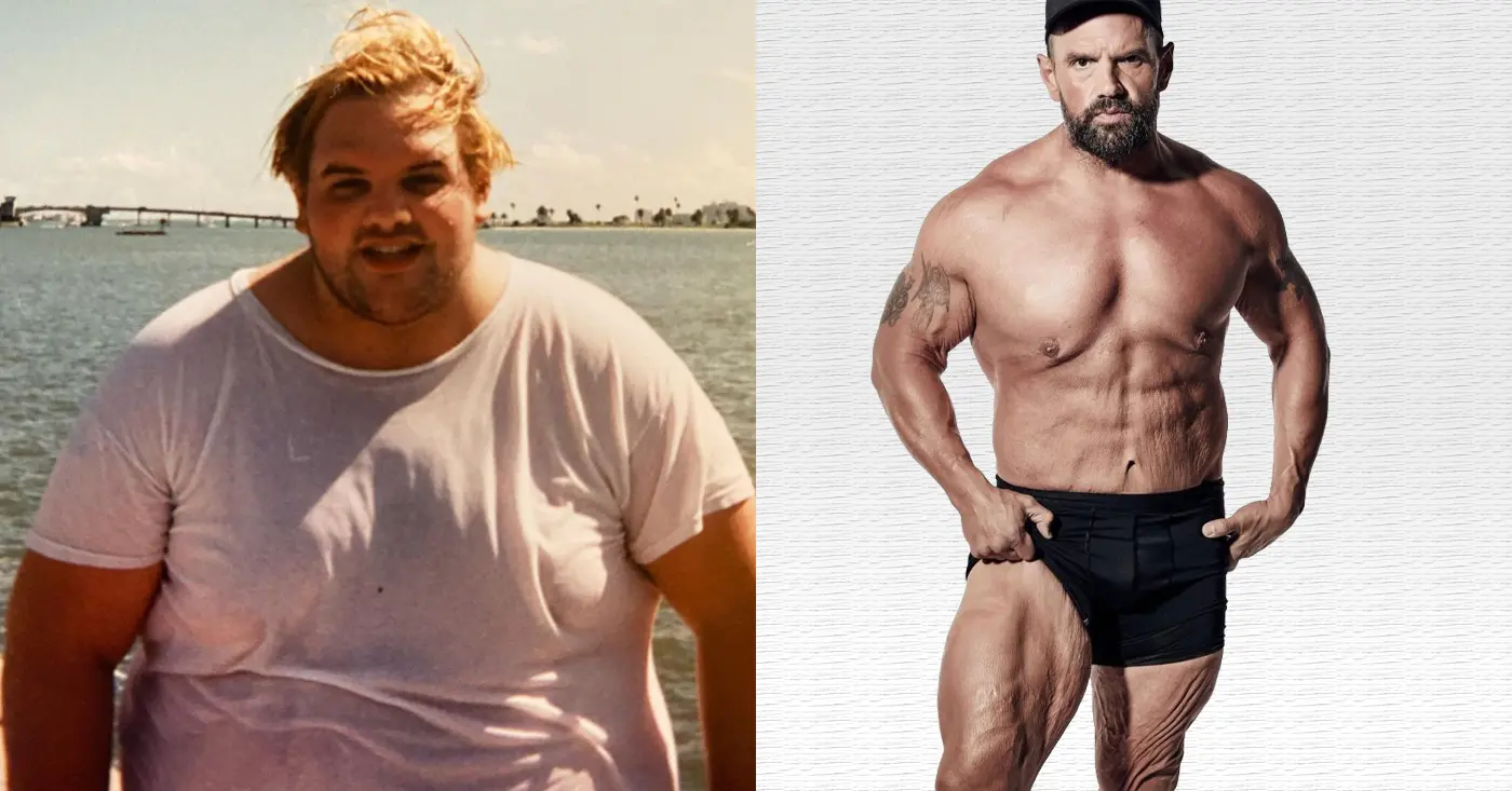 Loose Skin After Weight Loss