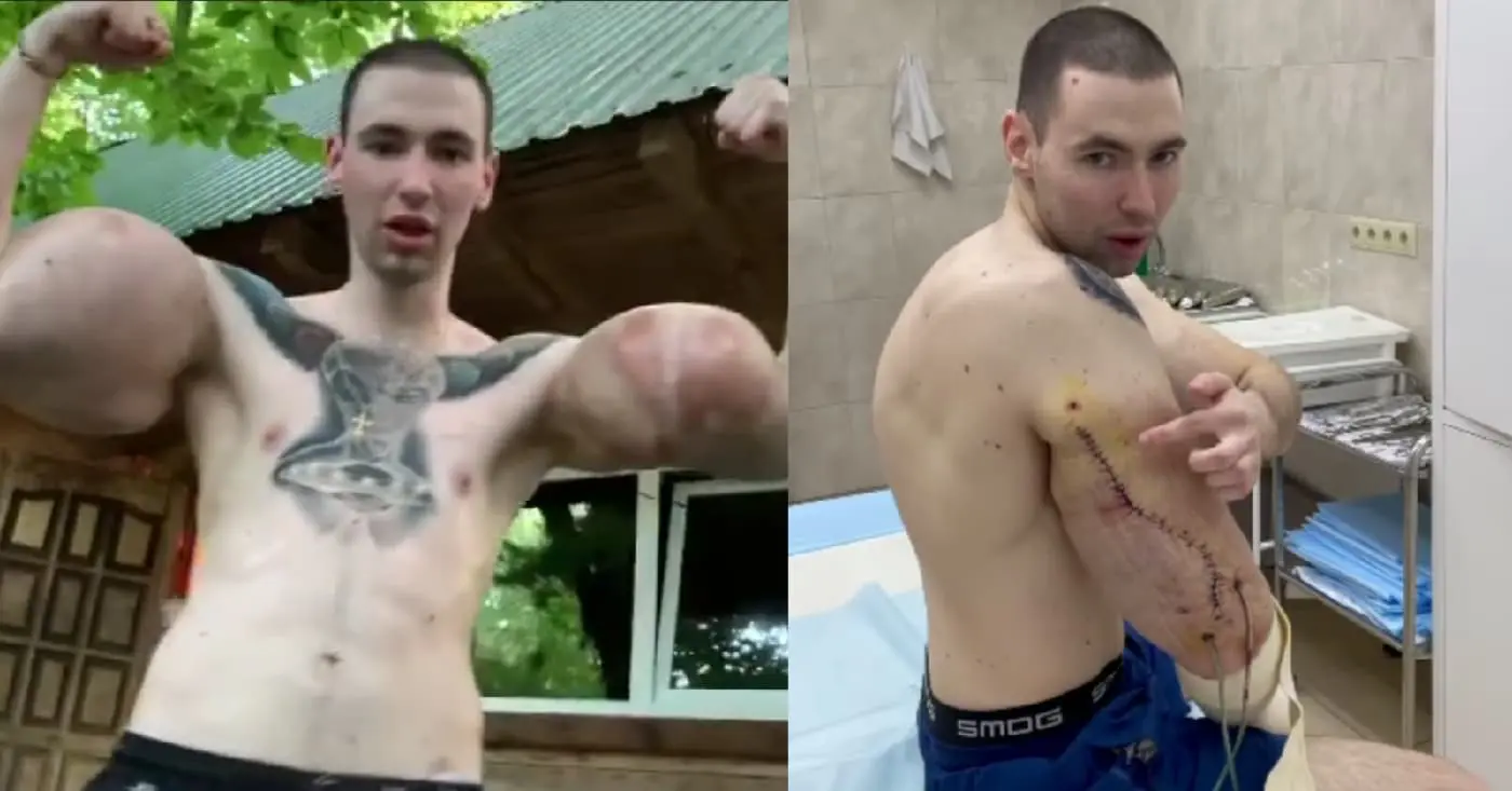 Kirill Tereshin Synthol Kid