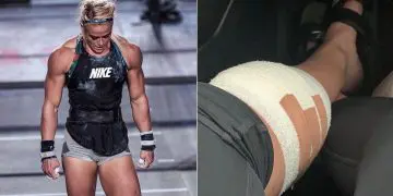 Sara Sigmundsdottir Ruptures ACL