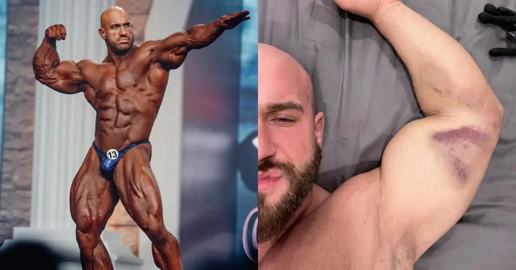 Antoine Vaillant