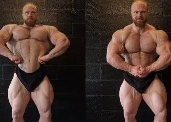 James Hollingshead Gets Covid 19